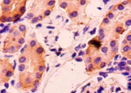 Hepatitis A virus cellular receptor 2 Polyclonal Antibody