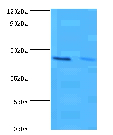 Hemoglobin subunit alpha Polyclonal Antibody