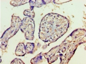 Histone deacetylase 8 Polyclonal Antibody