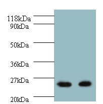 3-hydroxy-3 methylglutaryl-coenzyme A reductase Polyclonal Antibody