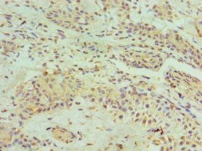 HNRNPM Polyclonal Antibody