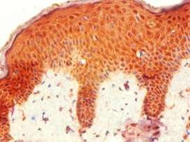 HOXB7 Polyclonal Antibody