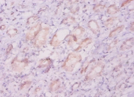 Potassium voltage-gated channel subfamily D member 1 Polyclonal Antibody