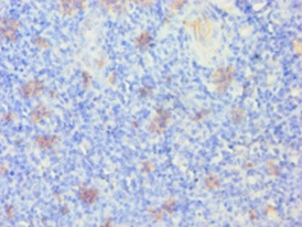 Keratin, type I cytoskeletal 14 Polyclonal Antibody