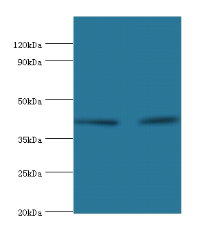 Lysosomal acid lipase/cholesteryl ester hydrolase Polyclonal Antibody