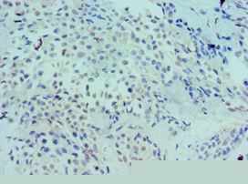 LRP6 Polyclonal Antibody