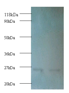Proteasome subunit beta type Polyclonal Antibody