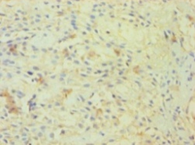 UDP-N-acetylglucosamine--peptide N-acetylglucosaminyltransferase 110 kDa subunit Polyclonal Antibody