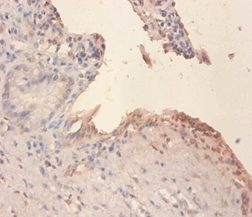 Phospholipid transfer Polyclonal Antibody