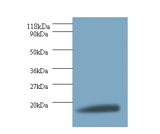 40S ribosomal protein S11 Polyclonal Antibody