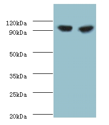 Glycogen phosphorylase, liver form Polyclonal Antibody