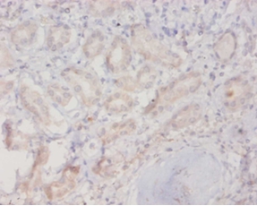 Ras-related protein Rab0 Polyclonal Antibody