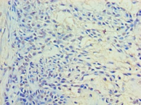 Ras-related protein Rab1A Polyclonal Antibody