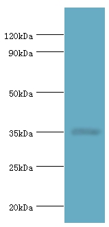 RAD51D Polyclonal Antibody