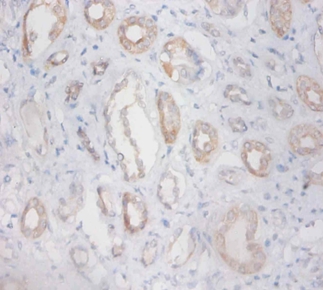 Zinc finger protein 91 Polyclonal Antibody
