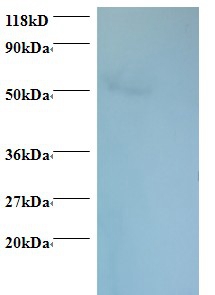 Rhombotin Polyclonal Antibody