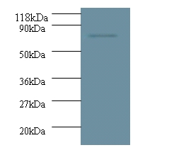 Deoxynucleoside triphosphate triphosphohydrolase SAMHD1