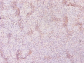 Solute carrier family 41 member 2 Polyclonal Antibody