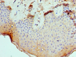 SLURP1 Polyclonal Antibody