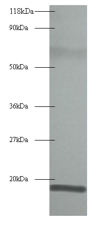 60S acidic ribosomal protein P1 Polyclonal Antibody