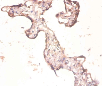 60S ribosomal protein L3 Polyclonal Antibody