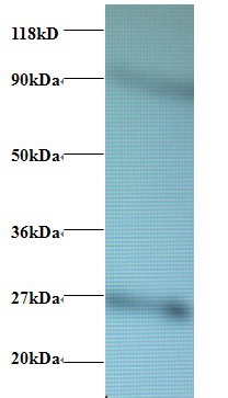 60S ribosomal protein L17 Polyclonal Antibody