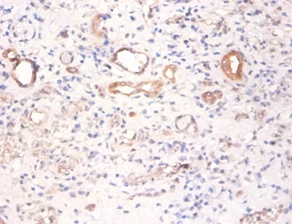 Pyruvate kinase PKM Polyclonal Antibody
