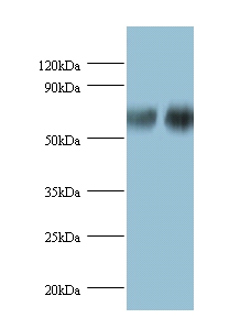 D-3-phosphoglycerate dehydrogenase Polyclonal Antibody