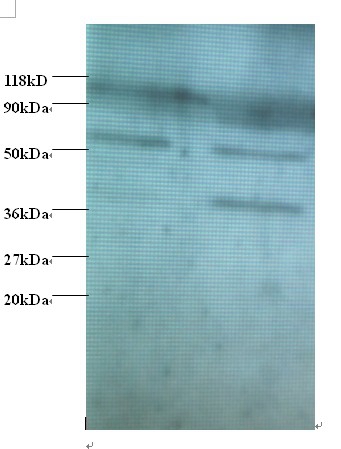 Heterogeneous nuclear ribonucleoprotein Q Polyclonal Antibody