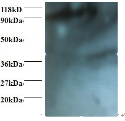 HCLS1-associated protein X Polyclonal Antibody