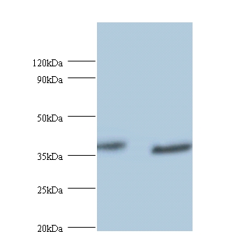 UV excision repair protein RAD23 homolog A Polyclonal Antibody