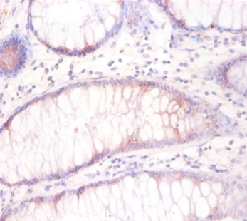 Tubulin beta-3 chain Polyclonal Antibody