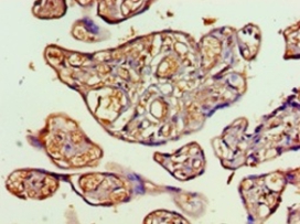 Transaldolase Polyclonal Antibody