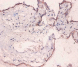 78 kDa glucose-regulated Polyclonal Antibody