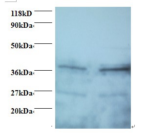Secretory carrier-associated membrane protein 3 Polyclonal Antibody