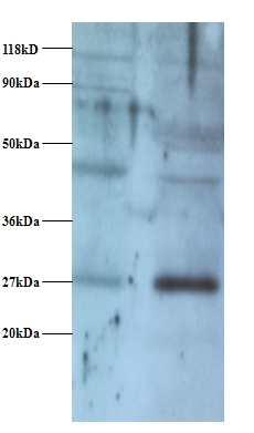 NADH dehydrogenase [ubiquinone] flavoprotein 2, mitochondrial Polyclonal Antibody