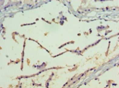 Serine/threonine-protein kinase PAK 4 Polyclonal Antibody