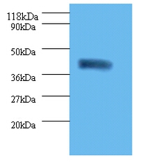 Acid-sensing ion channel 3 Polyclonal Antibody