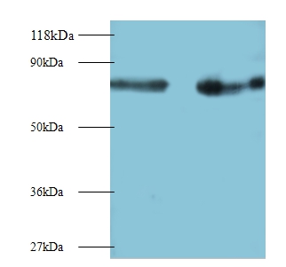 Interleukin2 subunit beta Polyclonal Antibody