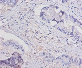 Interleukin5 Polyclonal Antibody