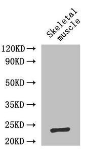 Interleukin-6 Polyclonal Antibody