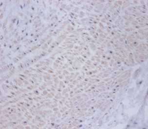 Cysteine and glycine-rich protein 2 Polyclonal Antibody
