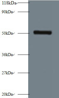 Interstitial collagenase Polyclonal Antibody