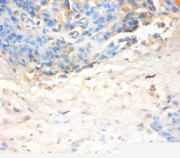 Antileukoproteinase Polyclonal Antibody
