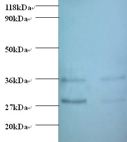 Protransforming growth factor alpha Polyclonal Antibody