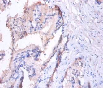 Matrilysin Polyclonal Antibody
