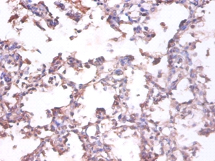Tumor necrosis factor ligand superfamily member 10 Polyclonal Antibody