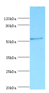 Vitamin D-binding protein Polyclonal Antibody