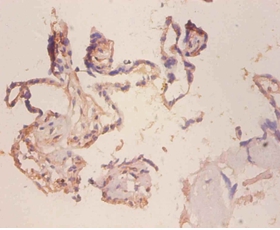 Cell surface glycoprotein MUC18 Polyclonal Antibody