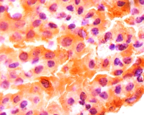 Midkine Polyclonal Antibody